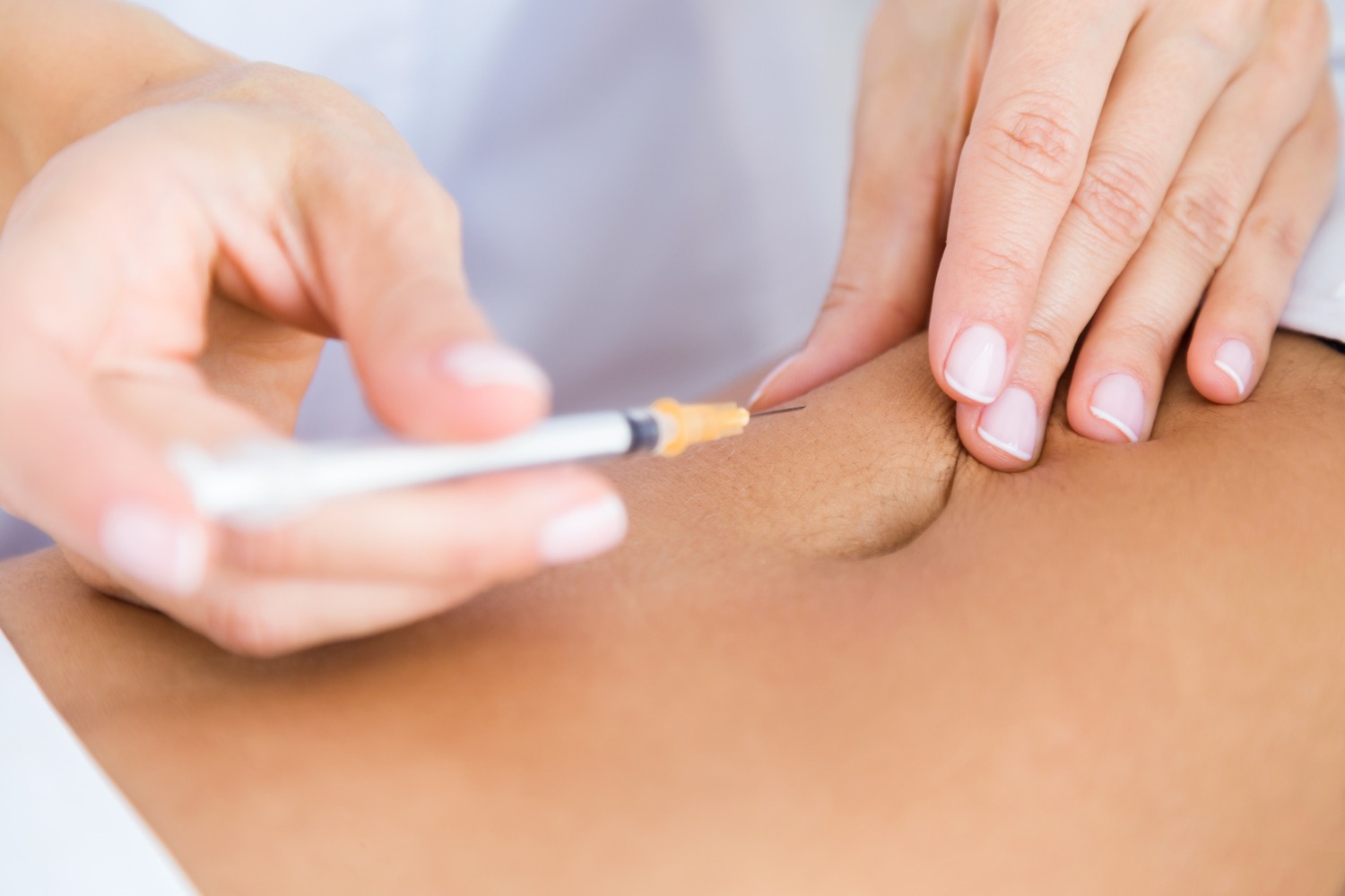 Bagaimana Kalau Stretch Mark Sudah Terlihat Jelas?